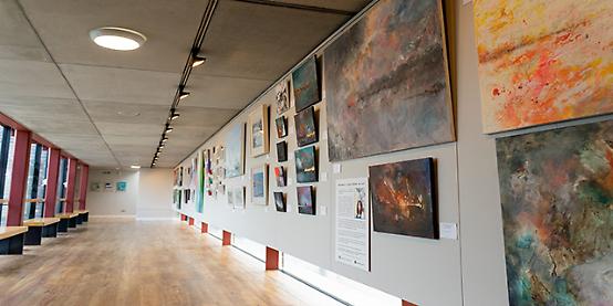 The art of living with brain injury