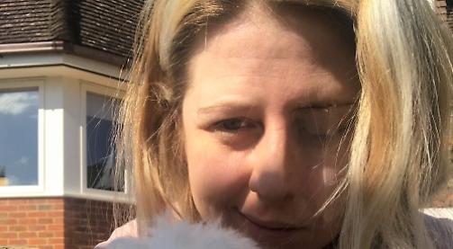 Visit to the dentist left me with paralysed face for two months