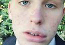 Footballer, 18, attacked by rival after match