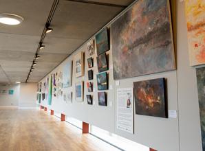 The art of living with brain injury