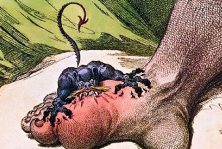 ’Rich man’s disease’ can affect anyone if you don’t look after yourself